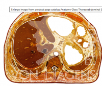 Anatomy Glass